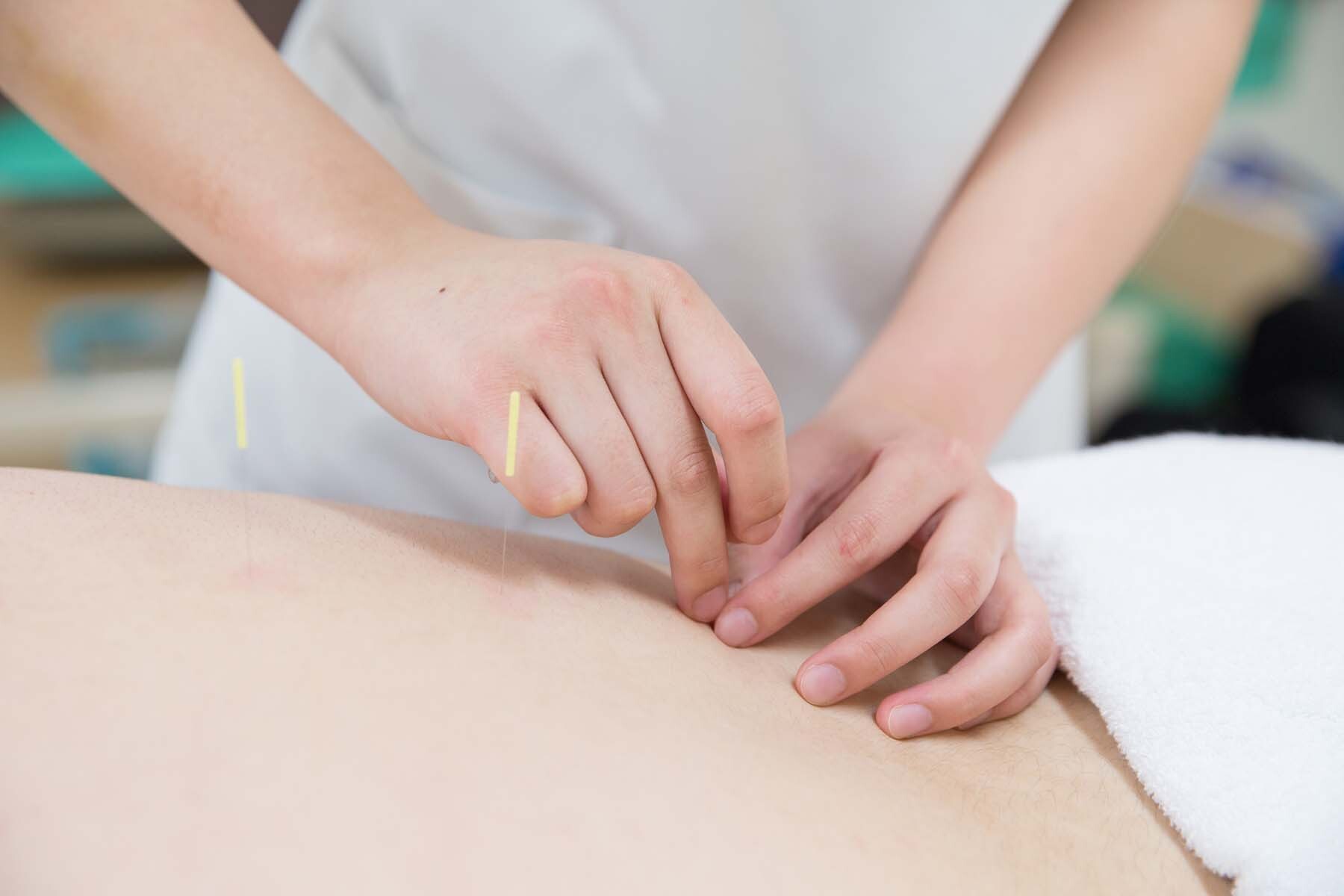 りんご鍼灸院 東京都目黒区 鍼灸院予約 検索サイト 健康にはり