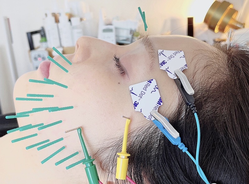 予約受付中】AOYAMA SALON YZ（東京都渋谷区） | 鍼灸院予約・検索