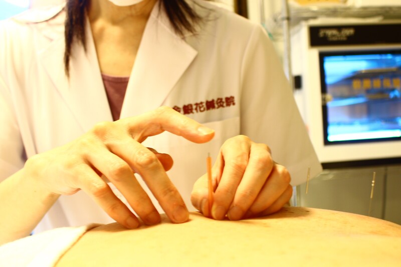 2 3 保険適用の相談可 宮城県全域の鍼灸院一覧 鍼灸院予約 検索サイト 健康にはり