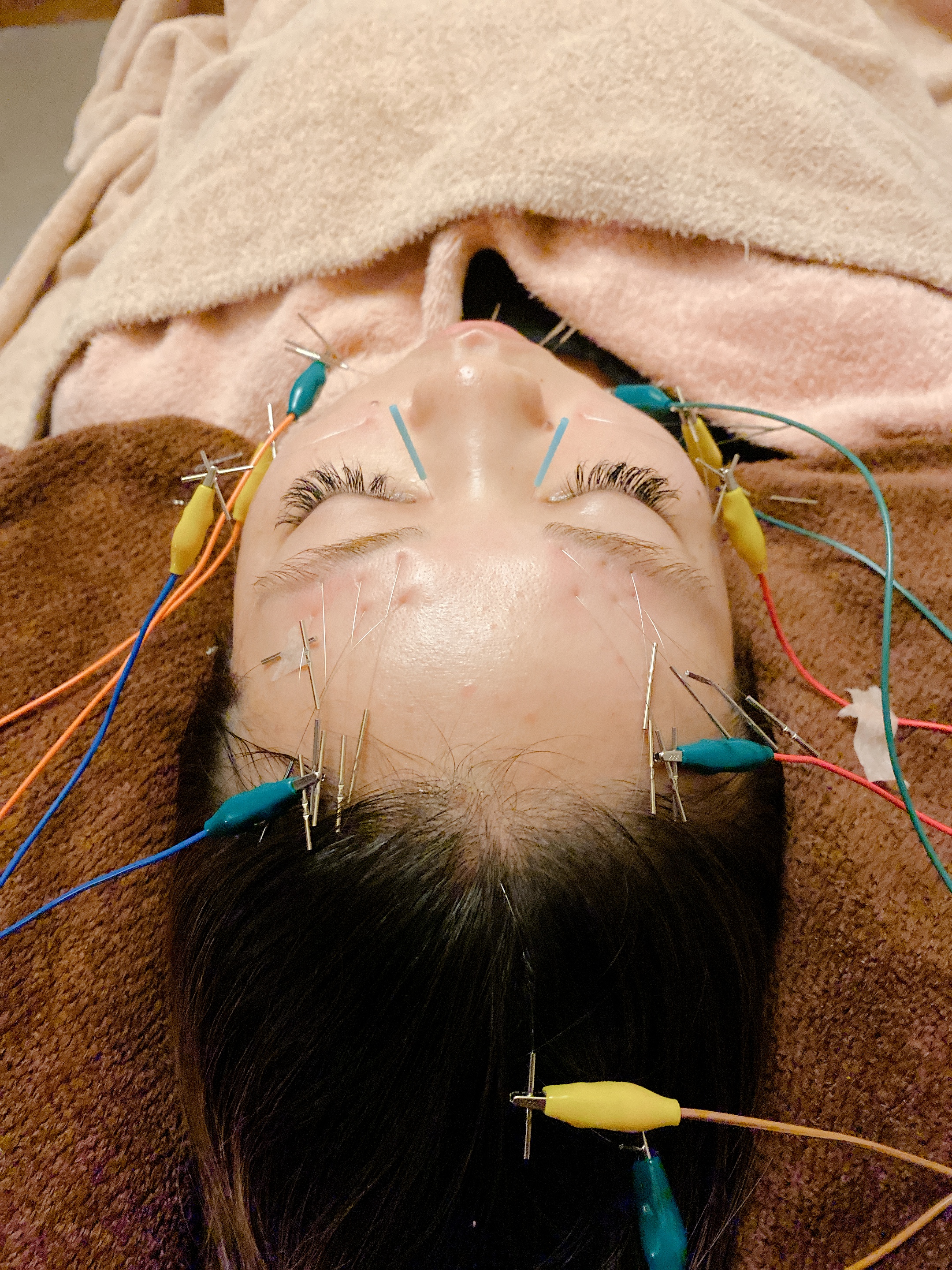 美容鍼灸 エステサロン Maxbeauty 静岡県静岡市駿河区 鍼灸院予約 検索サイト 健康にはり