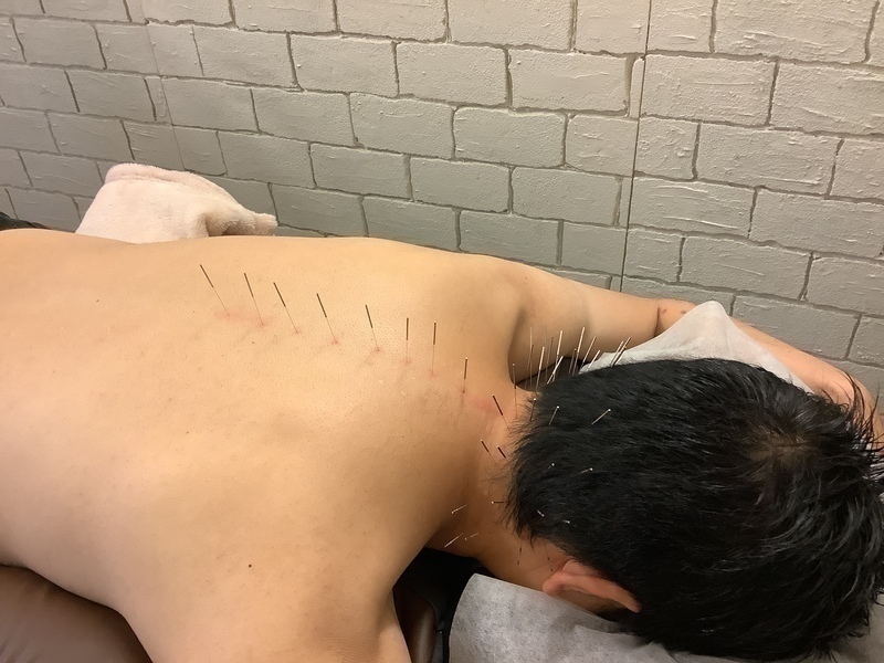 城ヶ崎さくら並木の鍼灸院