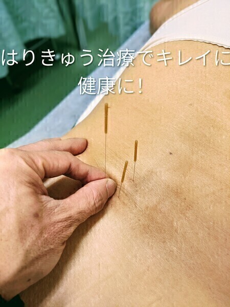 林はり接骨院