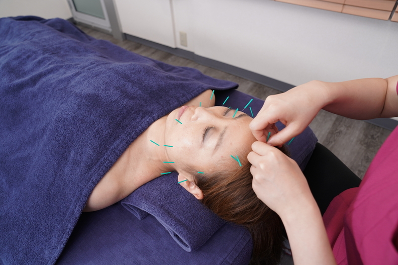 ビースタイル鍼灸治療院