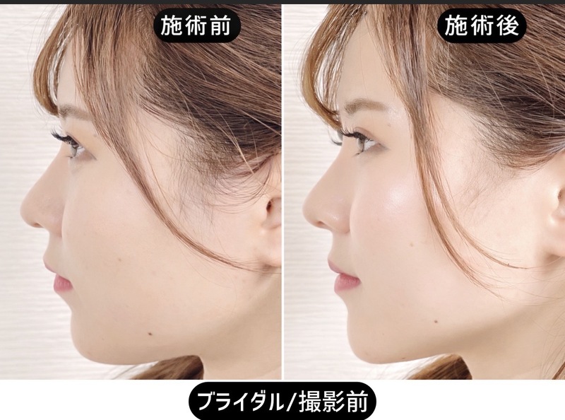 渋谷美容鍼 AOYAMA SALON YZ