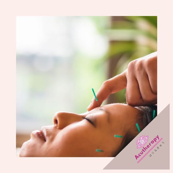 【女性専用美容鍼サロン】アキュセラピー　アネックス鍼灸室