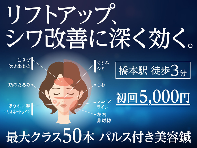 はり灸マッサージ　みなぎる美体　橋本分院