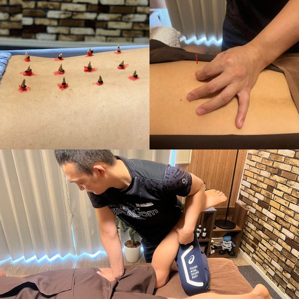 IKKYU〜はり•きゅう•マッサージ〜