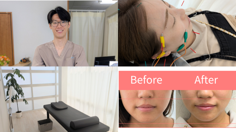 はりきゅうeFu-エフ-