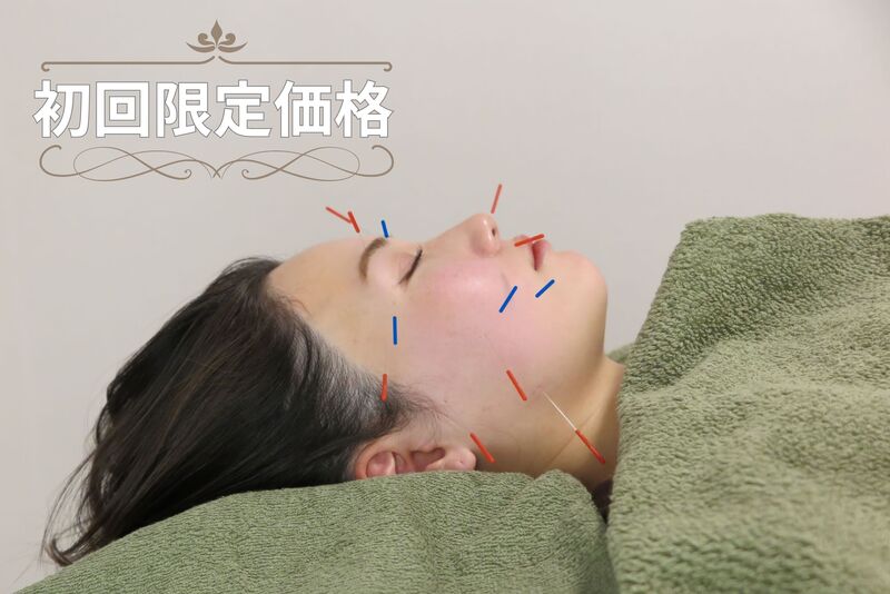 【初回限定】【美と健康のスペシャルコース】美容鍼灸トライアルコース