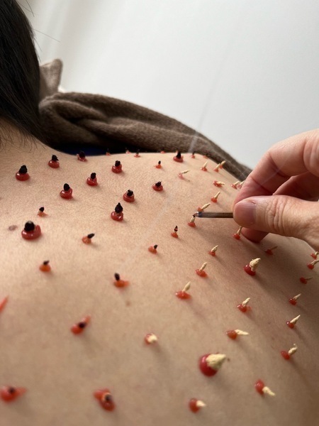 紫粋はりきゅう